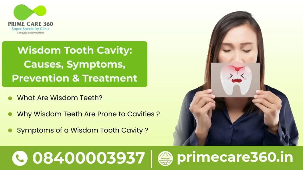 wisdom tooth cavity​